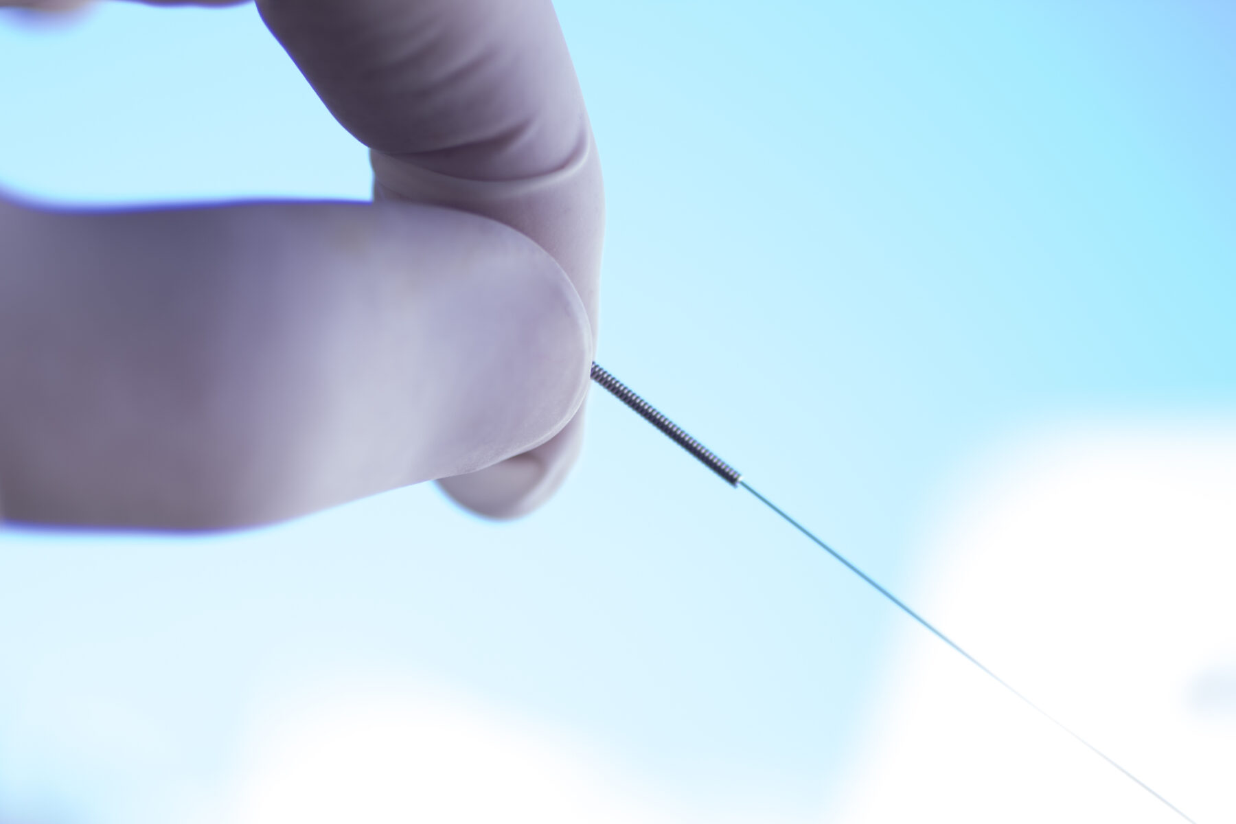 Dry Needling – First Choice Physical Therapy